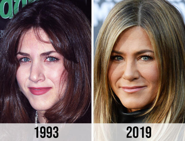 Jennifer Aniston’s Nose Job Journey: What Really Happened?
