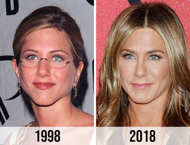 Jennifer Aniston’s Nose Job Journey: What Really Happened?