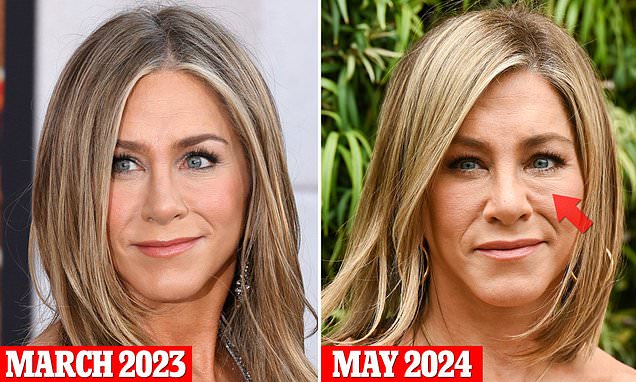 Jennifer Aniston’s Nose Job Journey: What Really Happened?