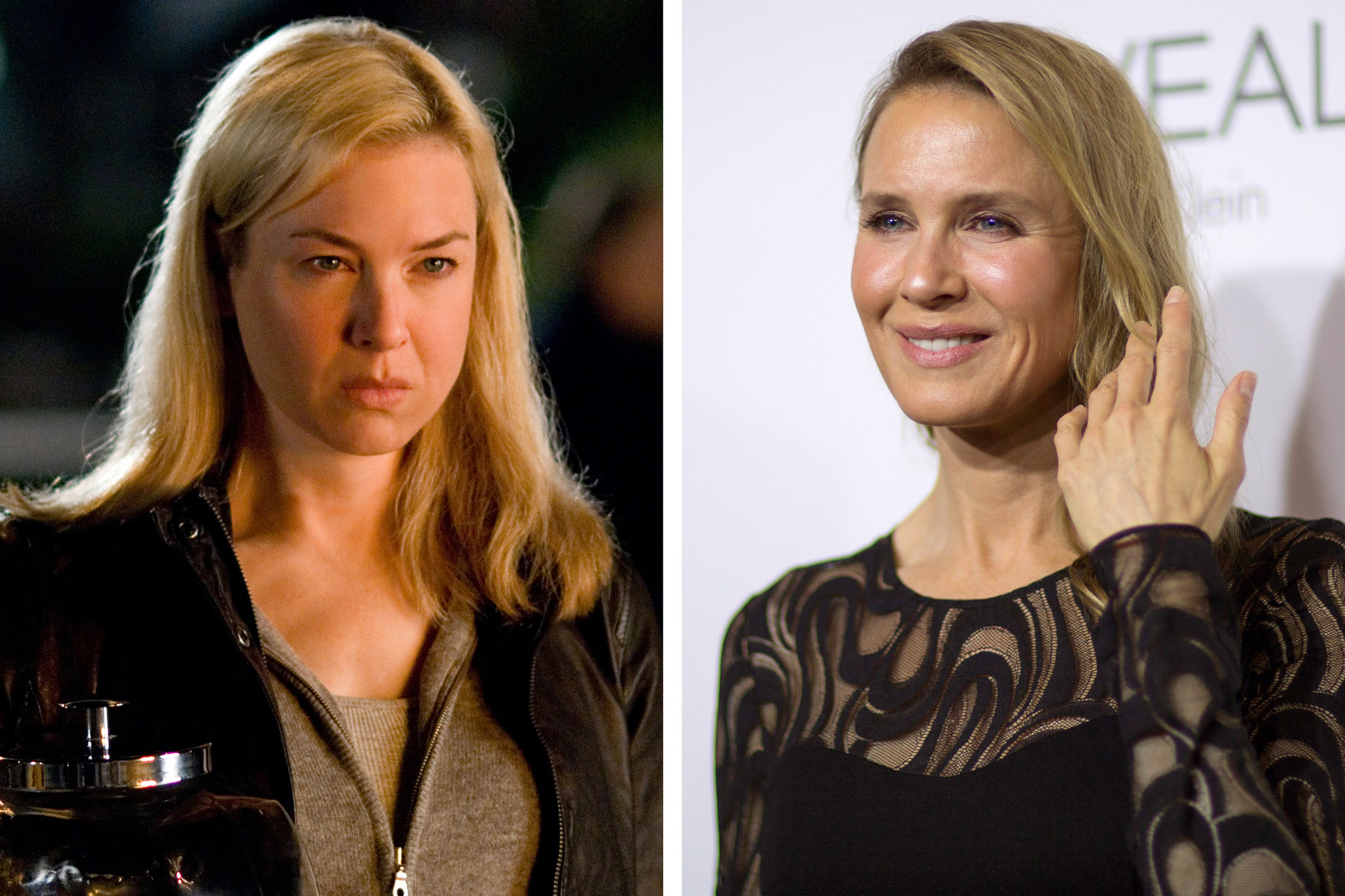 Renee Zellweger Before and After Plastic Surgery: Stunning Facial Changes Revealed