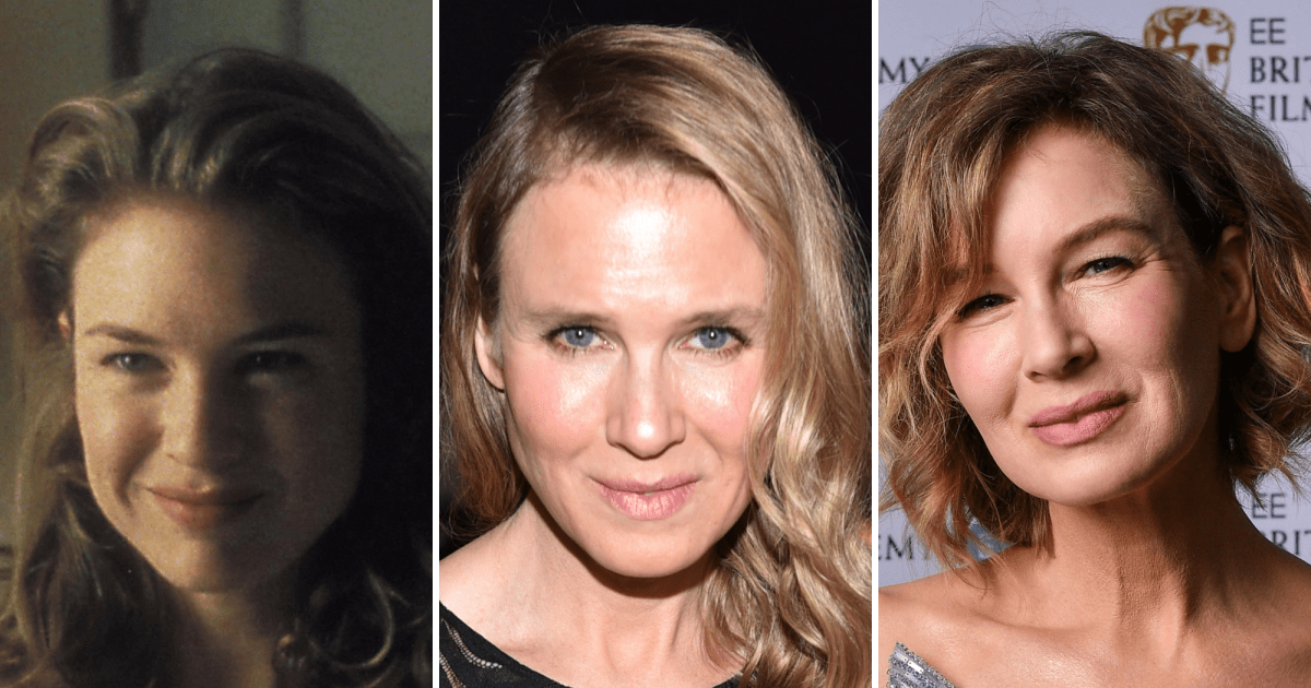 Renee Zellweger Before and After Plastic Surgery: Stunning Facial Changes Revealed