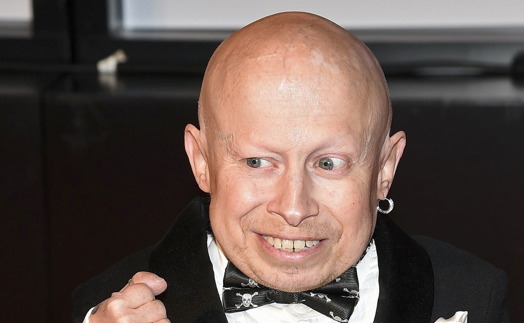 Verne Troyer Net Worth Revealed: The Truth Behind the Mini-Me Stars Wealth