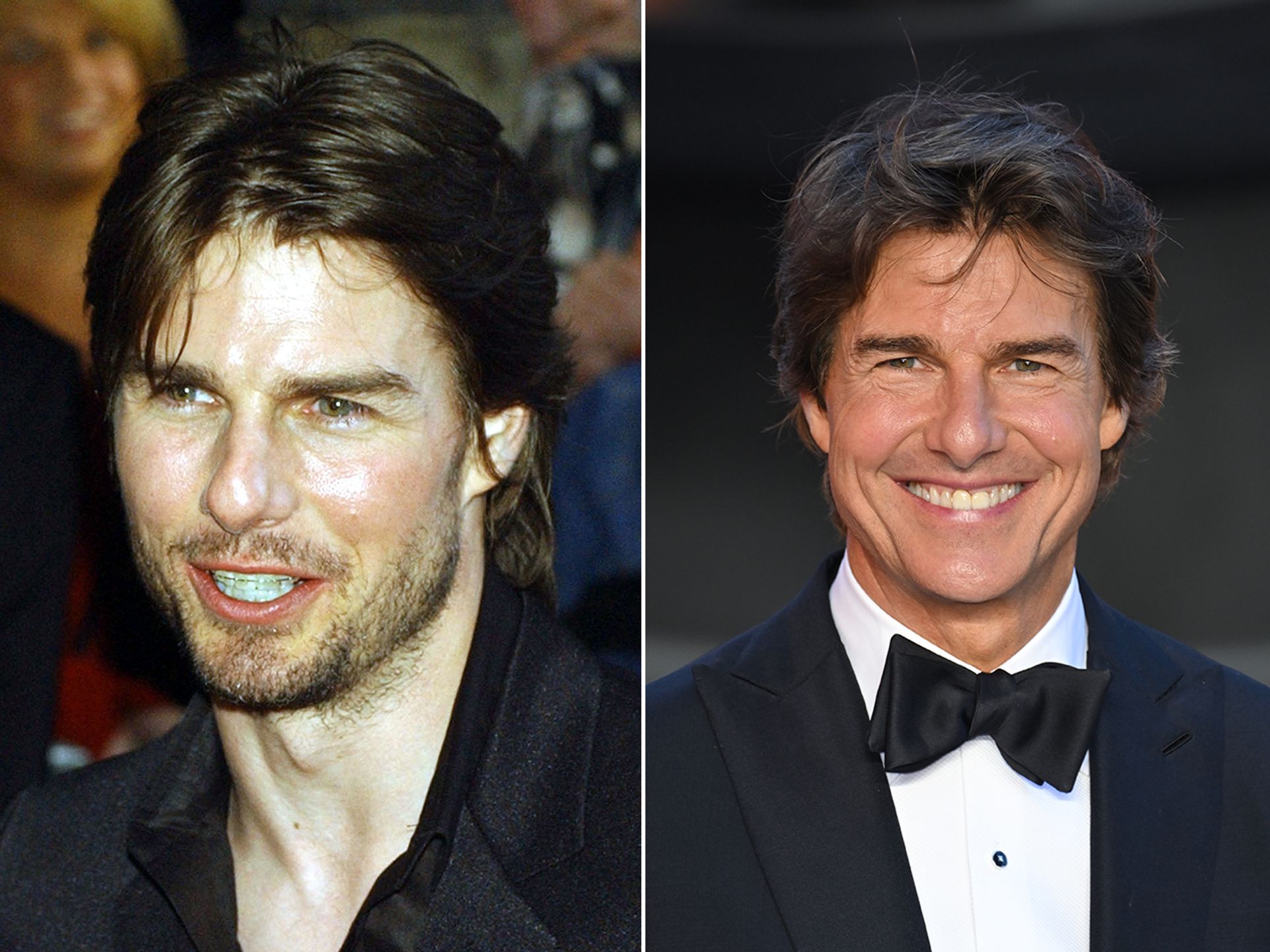 Tom Cruise Teeth Before and After: A Shocking Transformation