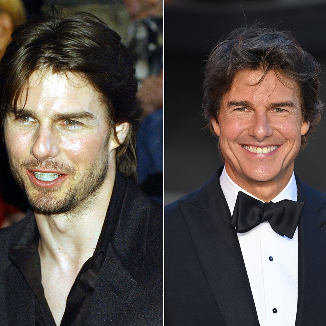 Tom Cruise Smile Transformation: The Complete Story You Need to Know