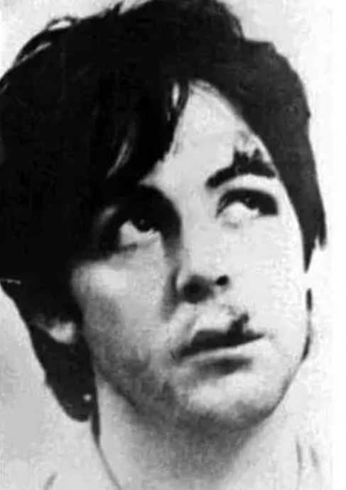 Paul McCartney Chipped Tooth Story: The Truth Behind the Smile.