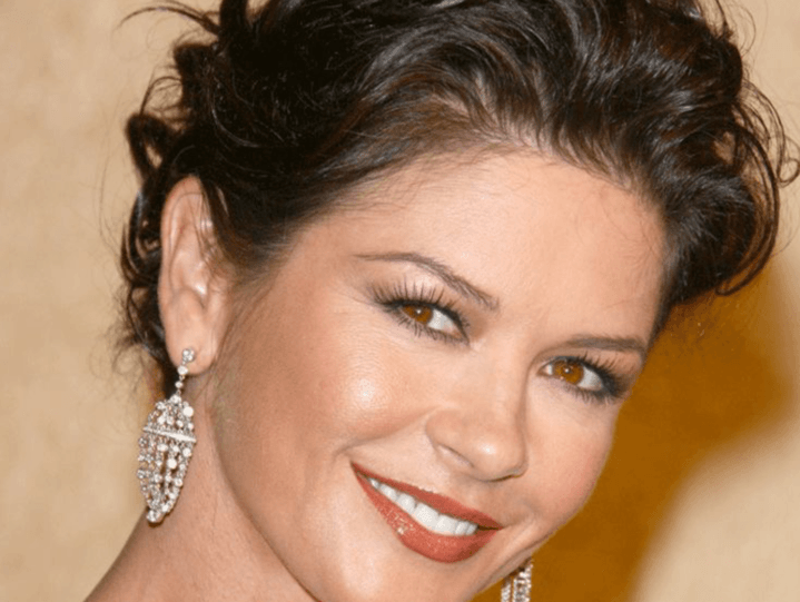 Actresses dentures: How common are they? (You wont believe which stars might have them!)