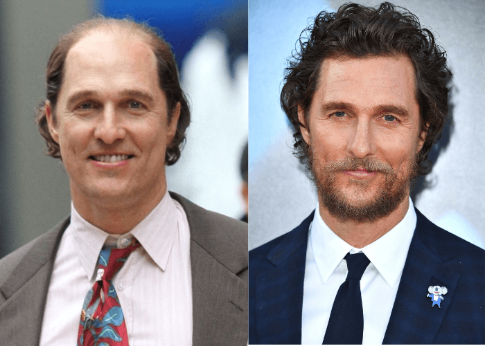 Famous People Who Wear Wigs: The Truth About Celebrity Hair Secrets!